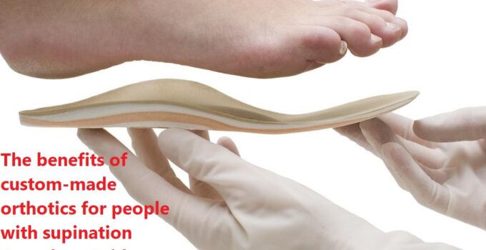 The benefits of custom-made orthotics for people with supination Complete Guide