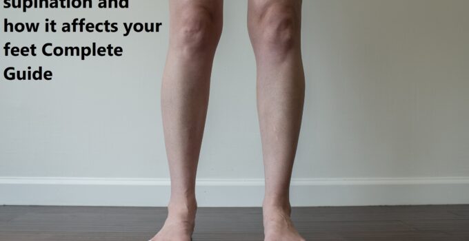 Understanding supination and how it affects your feet Complete Guide